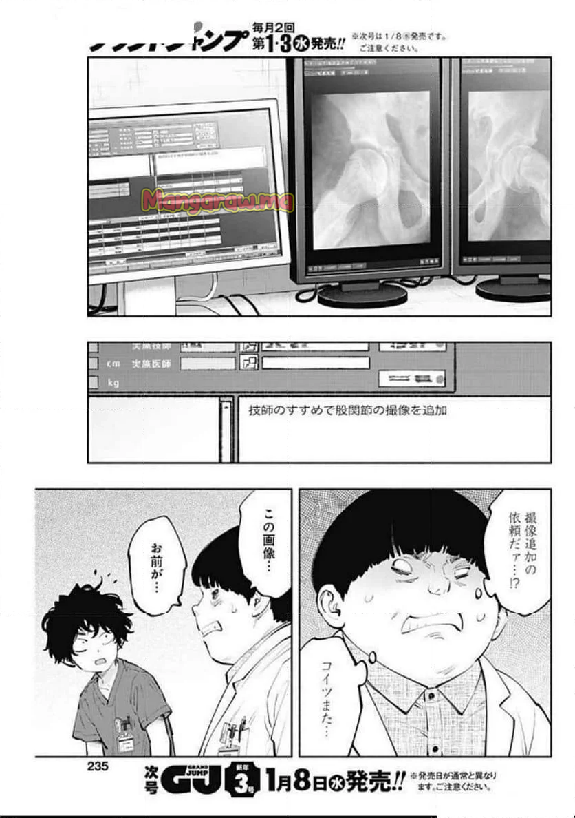 ラジエーションハウス 漫画 - 第146話 - Page 3